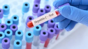 Mortalidade por hepatite viral cresce entre idosos e chega a 20,9% em pacientes acima de 80 anos
