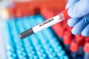 Exame de sangue para Alzheimer chega à rede particular no Brasil por até R$ 5 mil